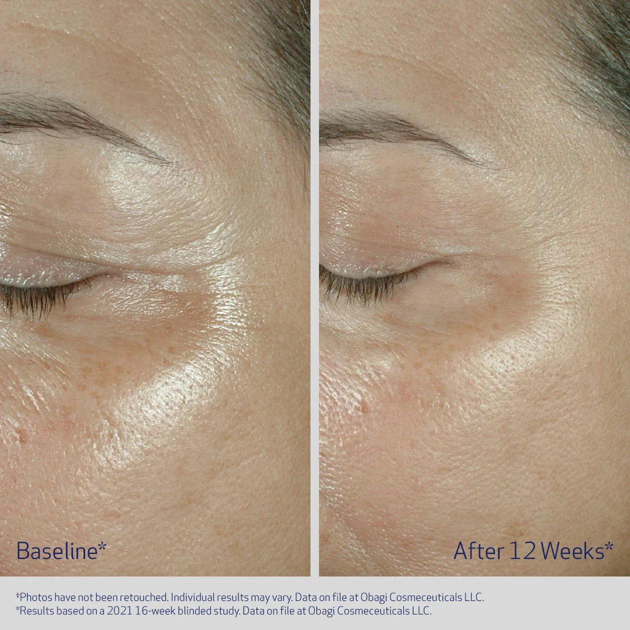 Obagi ELASTIderm Eye Cream 15g