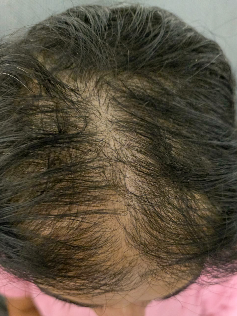 Hair after