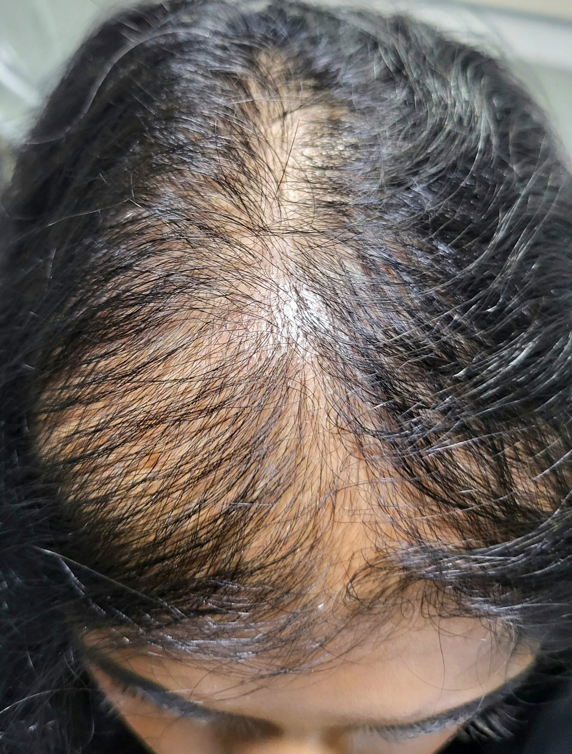 Hair before